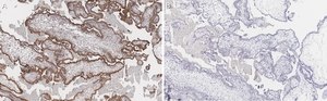 Anti-FAK Antibody, clone 1D14 ZooMAb® Rabbit Monoclonal recombinant, expressed in HEK 293 cells