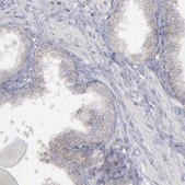 Anti-MYOM2 antibody produced in rabbit Ab1, Prestige Antibodies® Powered by Atlas Antibodies, affinity isolated antibody, buffered aqueous glycerol solution