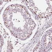 Anti-TAF6L antibody produced in rabbit Prestige Antibodies® Powered by Atlas Antibodies, affinity isolated antibody, buffered aqueous glycerol solution