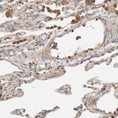 Anti-RAB11FIP1 antibody produced in rabbit Prestige Antibodies® Powered by Atlas Antibodies, affinity isolated antibody, buffered aqueous glycerol solution, Ab2
