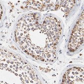 Anti-SSBP1 antibody produced in rabbit Prestige Antibodies® Powered by Atlas Antibodies, affinity isolated antibody, buffered aqueous glycerol solution