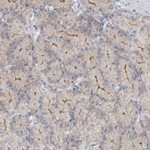 抗ADRB2抗体 ウサギ宿主抗体 Prestige Antibodies® Powered by Atlas Antibodies, affinity isolated antibody, buffered aqueous glycerol solution
