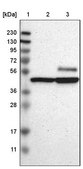 Anti-CAMK4 antibody produced in rabbit Prestige Antibodies® Powered by Atlas Antibodies, affinity isolated antibody, buffered aqueous glycerol solution