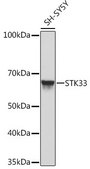 Anti-STK33 antibody produced in rabbit