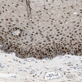 Anti-PITX1 antibody produced in rabbit Prestige Antibodies® Powered by Atlas Antibodies, affinity isolated antibody, buffered aqueous glycerol solution