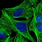 Anti-DEPDC4 antibody produced in rabbit Prestige Antibodies® Powered by Atlas Antibodies, affinity isolated antibody, buffered aqueous glycerol solution