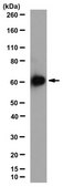 Anti-Hyaluronan synthase 2 Antibody, clone 2B11.1 clone 2B11.1, from mouse