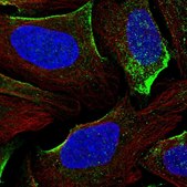 Anti-DGKG antibody produced in rabbit Prestige Antibodies® Powered by Atlas Antibodies, affinity isolated antibody, buffered aqueous glycerol solution