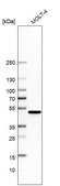 Anti-CTBP1 antibody produced in rabbit Prestige Antibodies® Powered by Atlas Antibodies, affinity isolated antibody, buffered aqueous glycerol solution