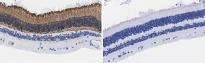 Anti-Recoverin Antibody, clone 1K10 ZooMAb® Rabbit Monoclonal recombinant, expressed in HEK 293 cells