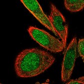 Anti-TNIP2 antibody produced in rabbit Prestige Antibodies® Powered by Atlas Antibodies, affinity isolated antibody, buffered aqueous glycerol solution