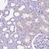 Anti-DHRS2 antibody produced in rabbit Prestige Antibodies® Powered by Atlas Antibodies, affinity isolated antibody, buffered aqueous glycerol solution