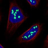 Anti-NOC2L antibody produced in rabbit Prestige Antibodies® Powered by Atlas Antibodies, affinity isolated antibody, buffered aqueous glycerol solution