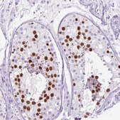 Anti-RACGAP1 antibody produced in rabbit Prestige Antibodies® Powered by Atlas Antibodies, affinity isolated antibody, buffered aqueous glycerol solution