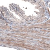 Monoclonal Anti-PGM1 antibody produced in mouse Prestige Antibodies® Powered by Atlas Antibodies, clone CL3299, purified immunoglobulin, buffered aqueous glycerol solution
