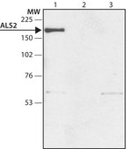 Anti-ALS2 (N-terminal region) antibody produced in rabbit ~1.5 mg/mL, affinity isolated antibody