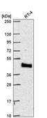 Anti-MTMR9 antibody produced in rabbit Prestige Antibodies® Powered by Atlas Antibodies, affinity isolated antibody
