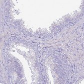 Anti-CLEC4M antibody produced in rabbit Prestige Antibodies® Powered by Atlas Antibodies, affinity isolated antibody, buffered aqueous glycerol solution