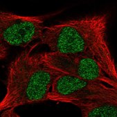 Anti-SCML4 antibody produced in rabbit Prestige Antibodies® Powered by Atlas Antibodies, affinity isolated antibody