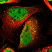 Anti-CDK9 antibody produced in rabbit Prestige Antibodies® Powered by Atlas Antibodies, affinity isolated antibody, buffered aqueous glycerol solution