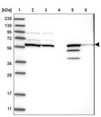 Anti-CERKL antibody produced in rabbit Prestige Antibodies® Powered by Atlas Antibodies, affinity isolated antibody, buffered aqueous glycerol solution