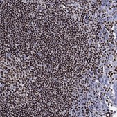 Anti-IKZF3 antibody produced in rabbit Prestige Antibodies® Powered by Atlas Antibodies, affinity isolated antibody, buffered aqueous glycerol solution