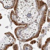 Anti-NAB2 antibody produced in rabbit Prestige Antibodies® Powered by Atlas Antibodies, affinity isolated antibody, buffered aqueous glycerol solution
