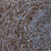 Anti-ADGRE5 antibody produced in rabbit Prestige Antibodies® Powered by Atlas Antibodies, affinity isolated antibody, buffered aqueous glycerol solution