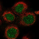 Anti-DDX51 antibody produced in rabbit Prestige Antibodies® Powered by Atlas Antibodies, affinity isolated antibody, buffered aqueous glycerol solution