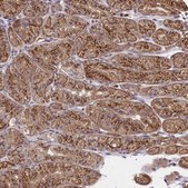 Anti-SEC24C antibody produced in rabbit Prestige Antibodies® Powered by Atlas Antibodies, affinity isolated antibody, buffered aqueous glycerol solution
