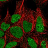 Anti-GTF3C6 antibody produced in rabbit Prestige Antibodies® Powered by Atlas Antibodies, affinity isolated antibody, buffered aqueous glycerol solution