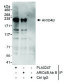 Rabbit anti-ARID4B Antibody, Affinity Purified Powered by Bethyl Laboratories, Inc.