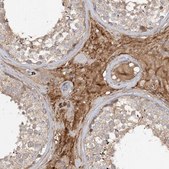 Anti-FGF19 antibody produced in rabbit Prestige Antibodies® Powered by Atlas Antibodies, affinity isolated antibody, buffered aqueous glycerol solution