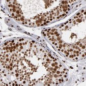 Anti-MRE11 antibody produced in rabbit Prestige Antibodies® Powered by Atlas Antibodies, affinity isolated antibody, buffered aqueous glycerol solution
