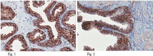 Anti-Girdin Antibody, CT, clone 10E6.1 clone 10E6.1, from mouse