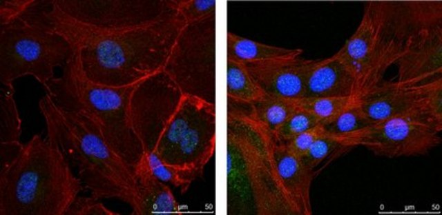 Anti-NR4A1 (Nur77) from rabbit, purified by affinity chromatography