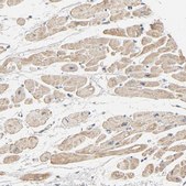 Anti-TRIOBP antibody produced in rabbit Prestige Antibodies® Powered by Atlas Antibodies, affinity isolated antibody, buffered aqueous glycerol solution