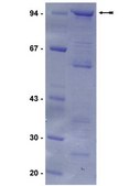 FKHR Protein, 100 µg N-terminal, Glutathione-Stransferase (GST) tagged, full-length fusion protein corresponding to human FKHR.