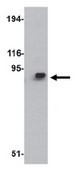 Anti-MACC1 Antibody from rabbit, purified by affinity chromatography