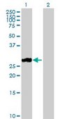 Anti-MMP7 antibody produced in rabbit purified immunoglobulin, buffered aqueous solution