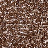 Anti-N4BP2L2 antibody produced in rabbit Prestige Antibodies® Powered by Atlas Antibodies, affinity isolated antibody, buffered aqueous glycerol solution