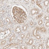 Anti-MYO10 antibody produced in rabbit Prestige Antibodies® Powered by Atlas Antibodies, affinity isolated antibody, buffered aqueous glycerol solution