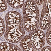 Anti-TOMM40 antibody produced in rabbit Prestige Antibodies® Powered by Atlas Antibodies, affinity isolated antibody, buffered aqueous glycerol solution