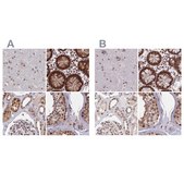 Anti-POLR2C antibody produced in rabbit Prestige Antibodies® Powered by Atlas Antibodies, affinity isolated antibody, buffered aqueous glycerol solution