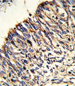 [KO Validated]Anti-HADHA antibody produced in rabbit [Knockout Validated],affinity isolated antibody, buffered aqueous solution