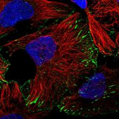 Anti-TRIM71 antibody produced in rabbit Prestige Antibodies® Powered by Atlas Antibodies, affinity isolated antibody, buffered aqueous glycerol solution