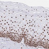 Anti-SRSF1 antibody produced in rabbit Prestige Antibodies® Powered by Atlas Antibodies, affinity isolated antibody, buffered aqueous glycerol solution
