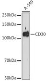 Anti-CD30 Antibody, clone 8N4G5, Rabbit Monoclonal