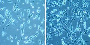 MCA205 Mouse Fibrosarcoma Cell Line MCA205 mouse fibrosarcoma cell line is an excellent model for studying immune response to tumor cells and the development of targeted cancer immunotherapies.