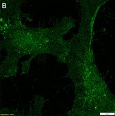 Anti-Neuropilin-1 Antibody, clone 1H21 ZooMAb® Rabbit Monoclonal recombinant, expressed in HEK 293 cells